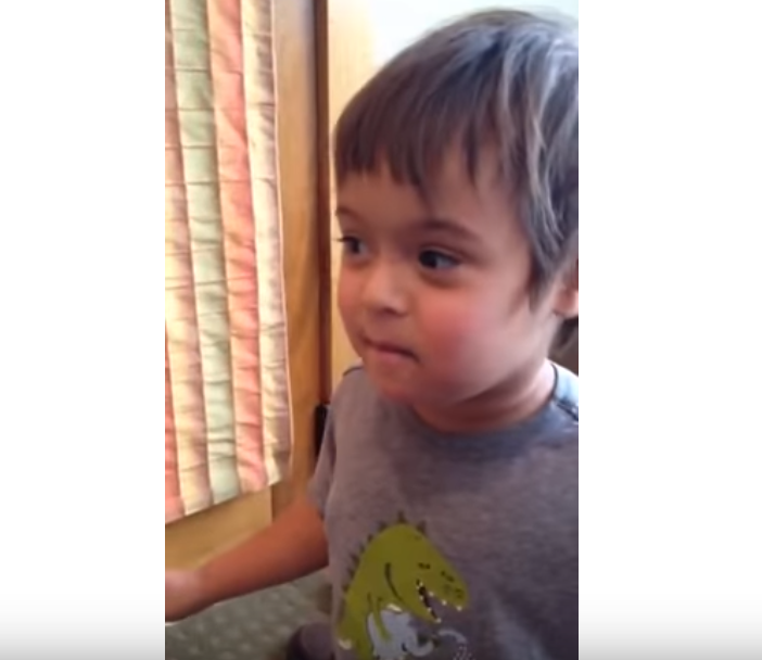 child with Down syndrome